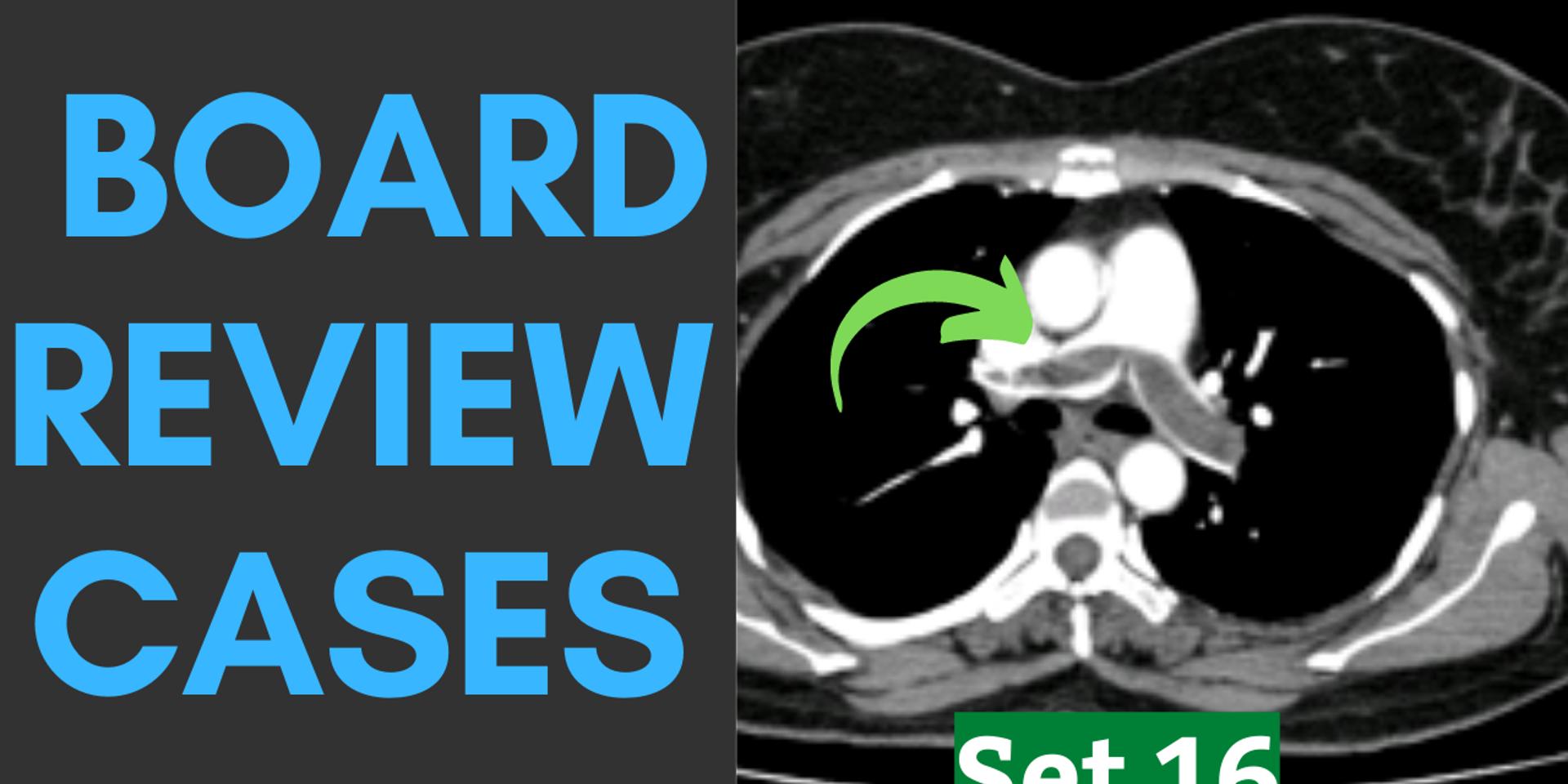 Cover Image for Rapid-Fire Radiology Spotters  [Quiz and Discussion] | RadioGyan.com